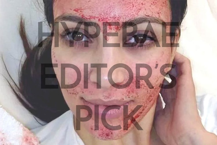 This $8 USD Facial Is a Bloody Mess but It Made My Skin Perfect
