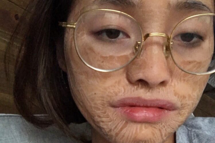 "Zombie Mask" Is the Scarily Good Skincare Trend Taking over the Beauty-Sphere