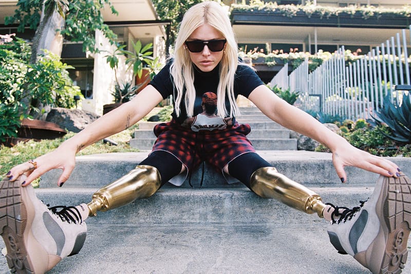 Model Lauren Wasser on Surviving Toxic Shock Syndrome and Creating Her Own Lane in Fashion