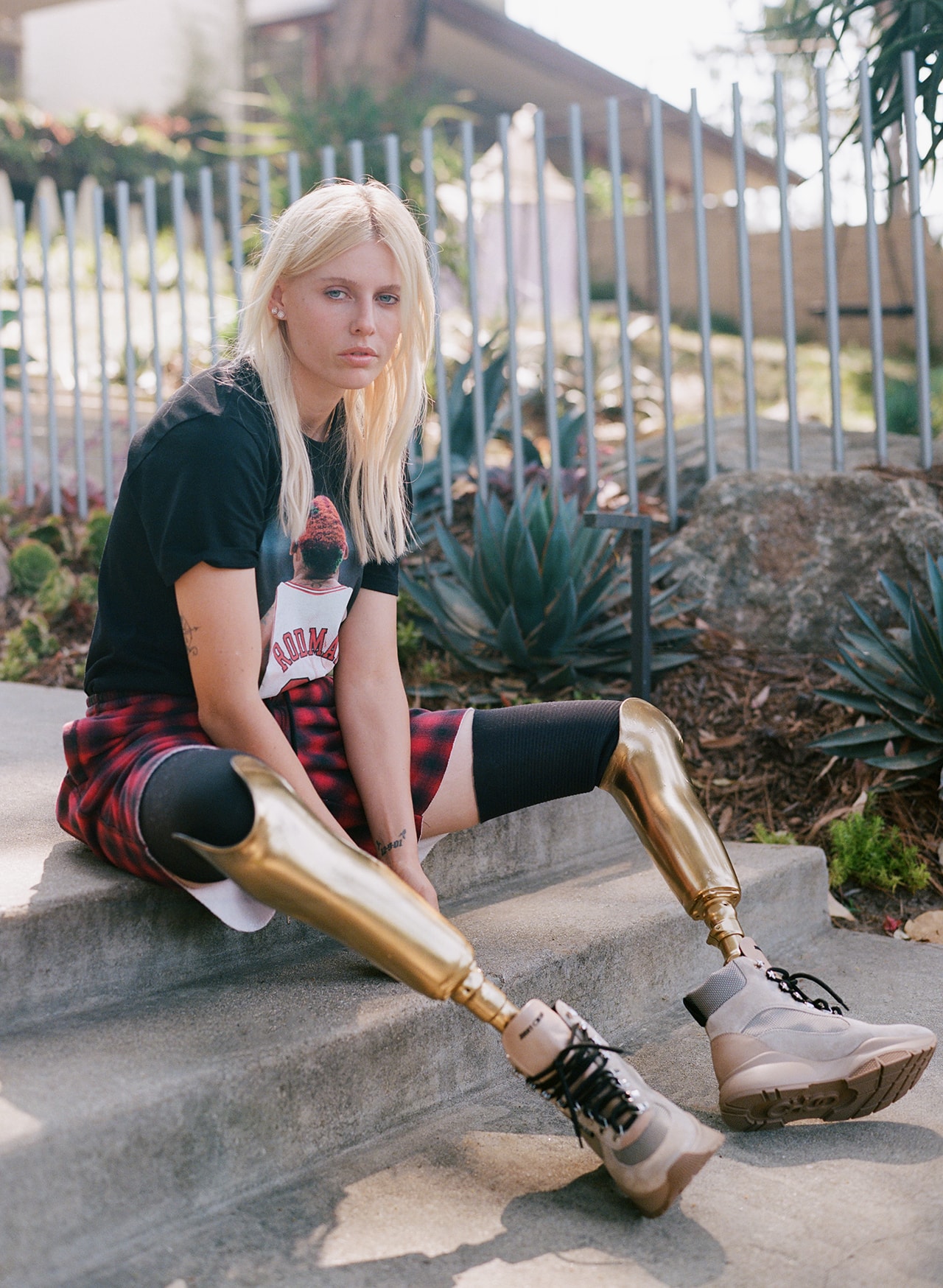Lauren Wasser Model Toxic Shock Syndrome Advocate Survivor Activist Golden Legs Double Amputee TSS Disability 