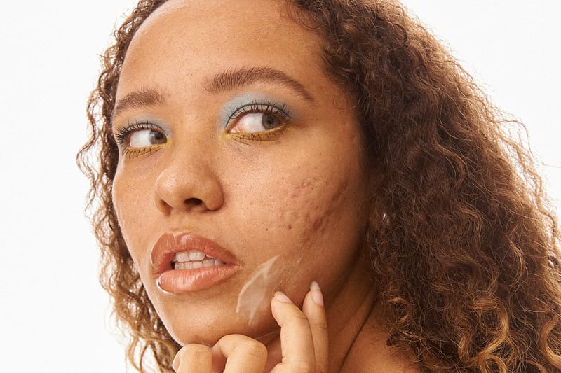 Clear Skin Does Not Define "GOOD SKIN," According to This Beauty Campaign
