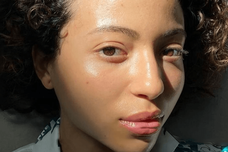 5 Best Facial Toners for Clear and Hydrated Skin