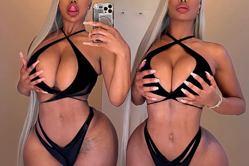 Men on Dating Apps Demand "Filler-Free" Women, New Trend Reveals