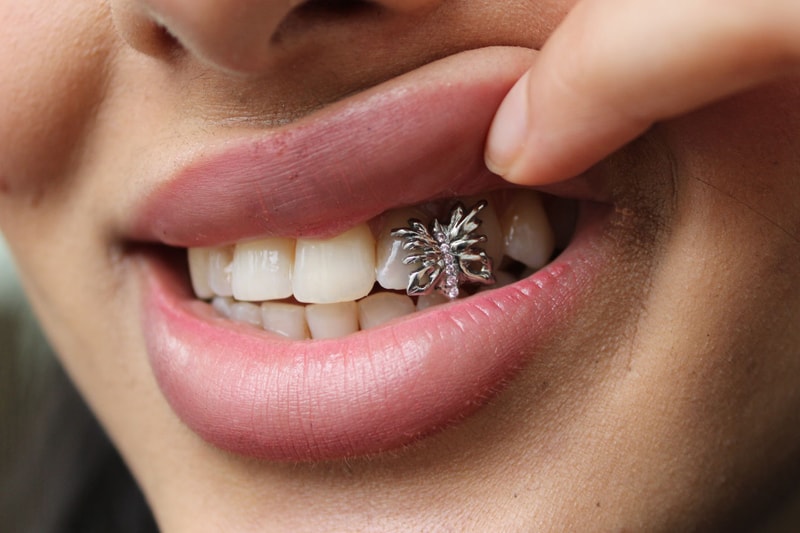 london grillz flannels tooth gems case silver gold charms design