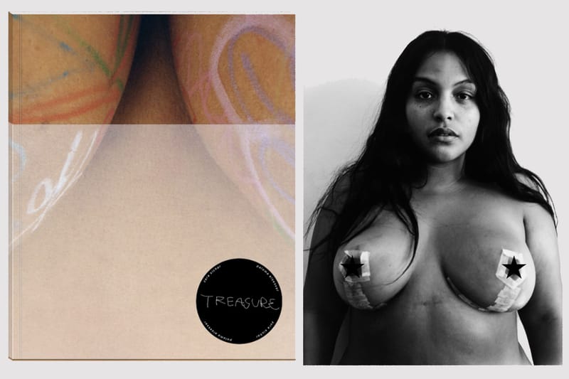 Zora Sicher's 'Treasure' Documents Paloma Elsesser's Journey Through Breast Surgery