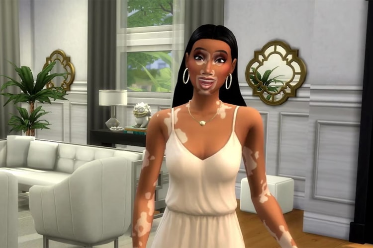 Winnie Harlow’s Vitiligo Skin Sims Is a Major Win for Representation