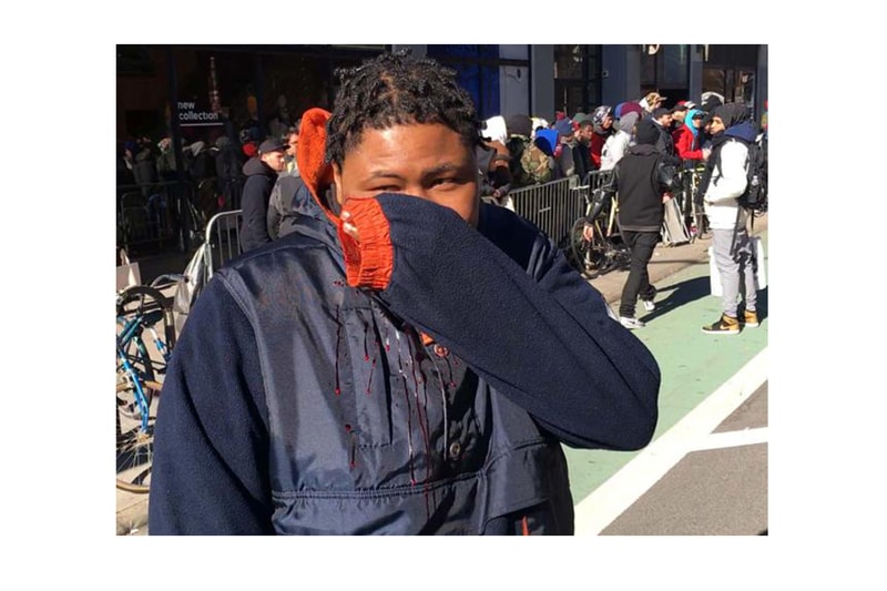 man slashed in face at supreme