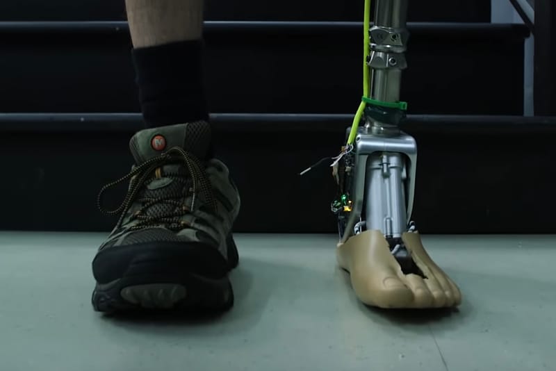 Un Professeur Vient De Développer Une Prothèse De Cheville Intelligente
