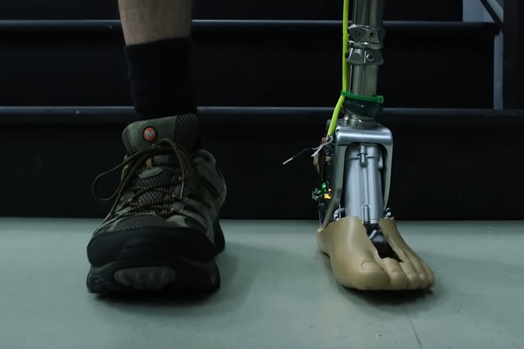 Un Professeur Vient De Développer Une Prothèse De Cheville Intelligente