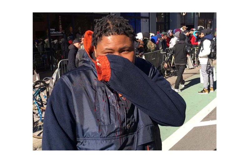 man slashed in face at supreme