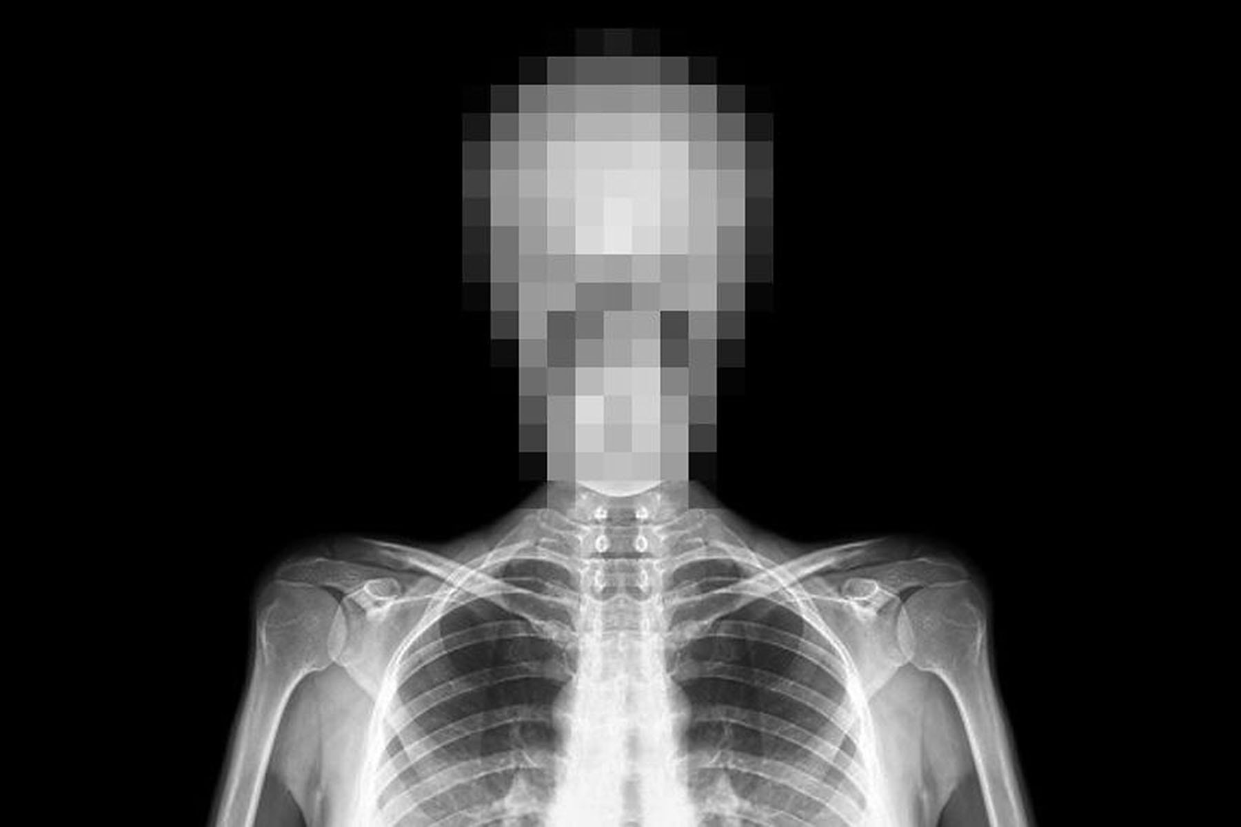 超逼真的 X 光塗鴉－藝術家 SHOK-1 與 BALLY 合作推出聯乘系列