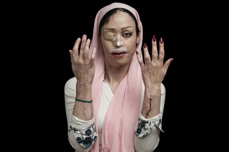 2016 Sony World Photography Award Winners