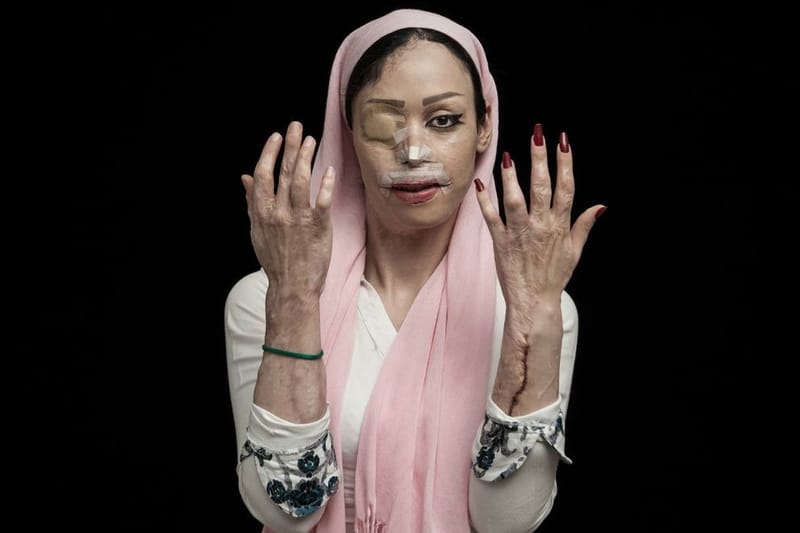 The 2016 Sony World Photography Award Winners