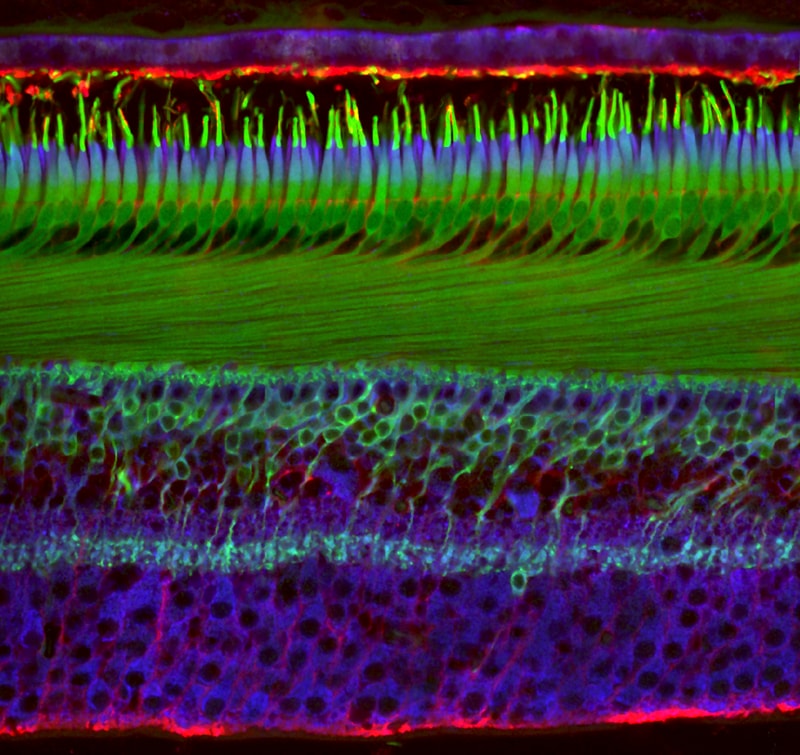 Nikon 2018 Small World Photomicrography competition Winners photography science microscope lens light imagery submit