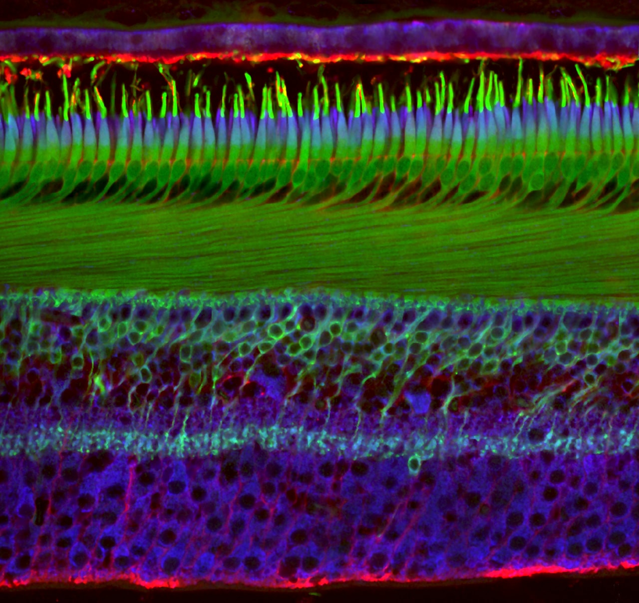 Nikon 2018 Small World Photomicrography competition Winners photography science microscope lens light imagery submit