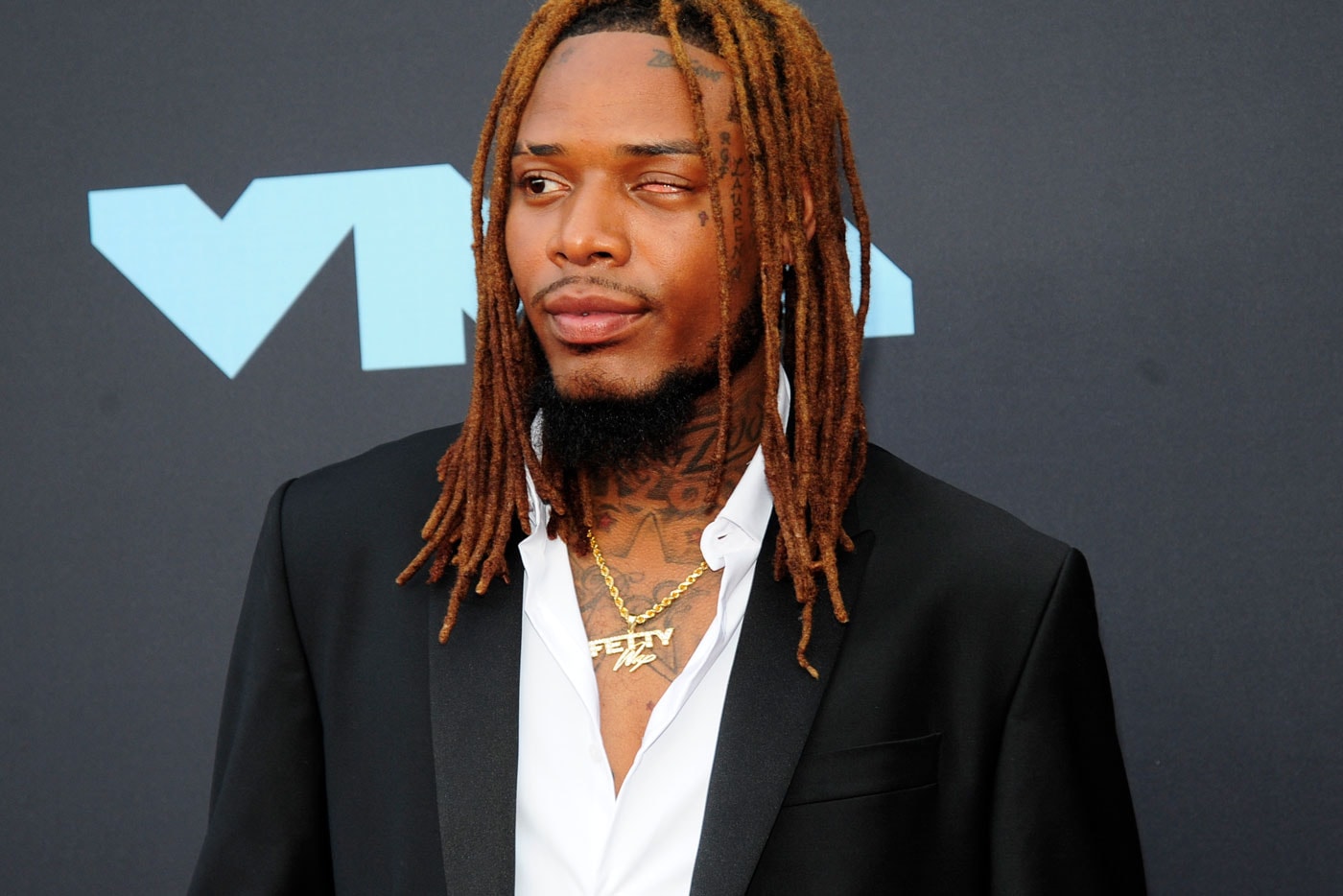 Why Fetty Wap Chooses to Go Without a Prosthetic Eye