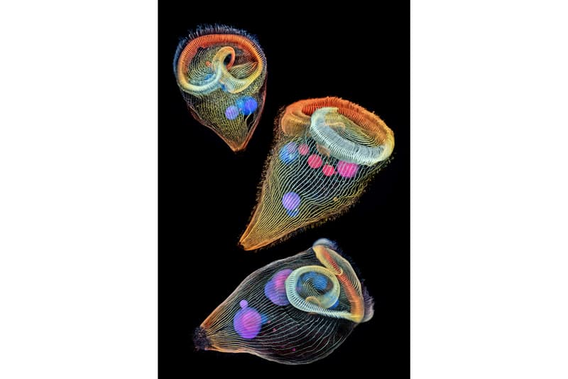 nikon small world photography winning images