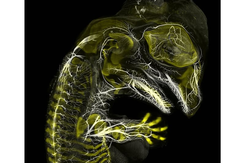 nikon small world photography winning images