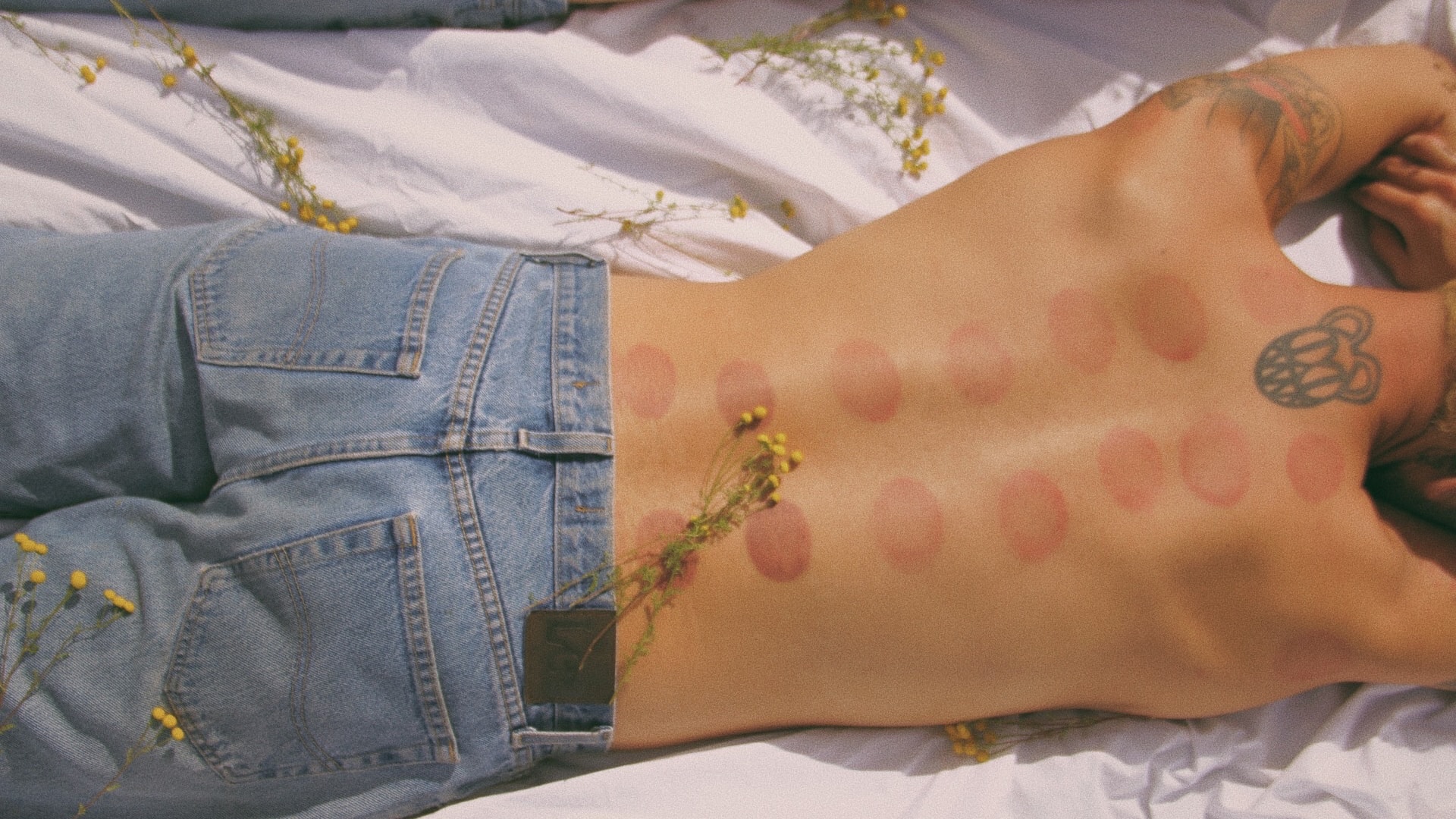 Mount Sunny Cupping Marks Stagnation Health 