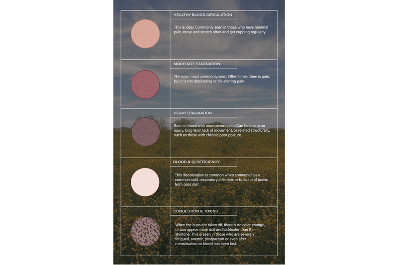 Mount Sunny Cupping Marks Stagnation Health 