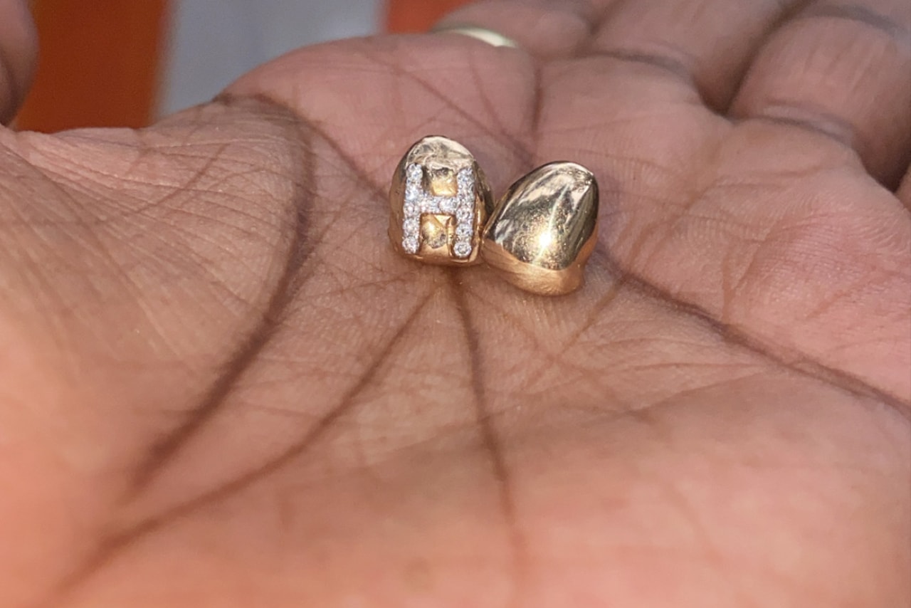 Helen Harris helenwiththegoldteeth Grillz New York Honeycomb Enamel Floating Letters Gemstones Opals Teardrop Gap Filler French Dip Diamond Cuts Openface Flats Caps Gold Teeth