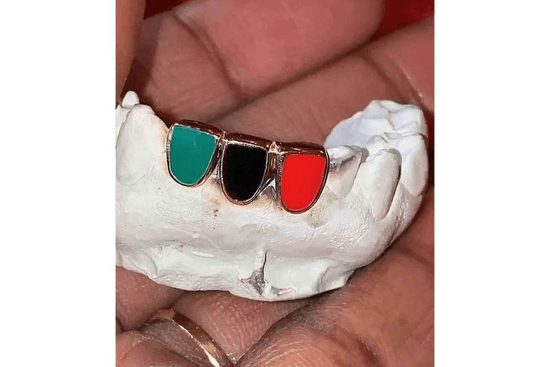 Helen Harris helenwiththegoldteeth Grillz New York Honeycomb Enamel Floating Letters Gemstones Opals Teardrop Gap Filler French Dip Diamond Cuts Openface Flats Caps Gold Teeth