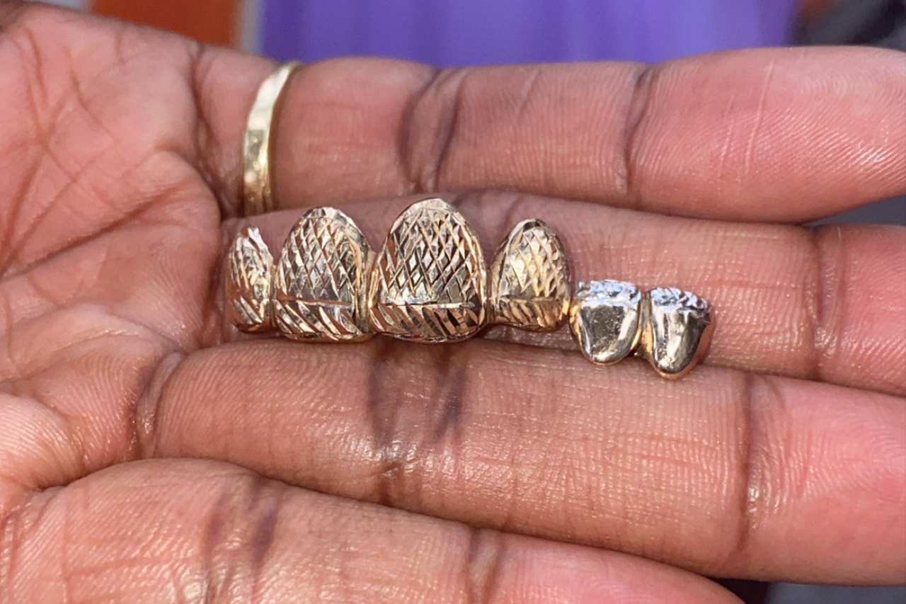 Helen Harris helenwiththegoldteeth Grillz New York Honeycomb Enamel Floating Letters Gemstones Opals Teardrop Gap Filler French Dip Diamond Cuts Openface Flats Caps Gold Teeth