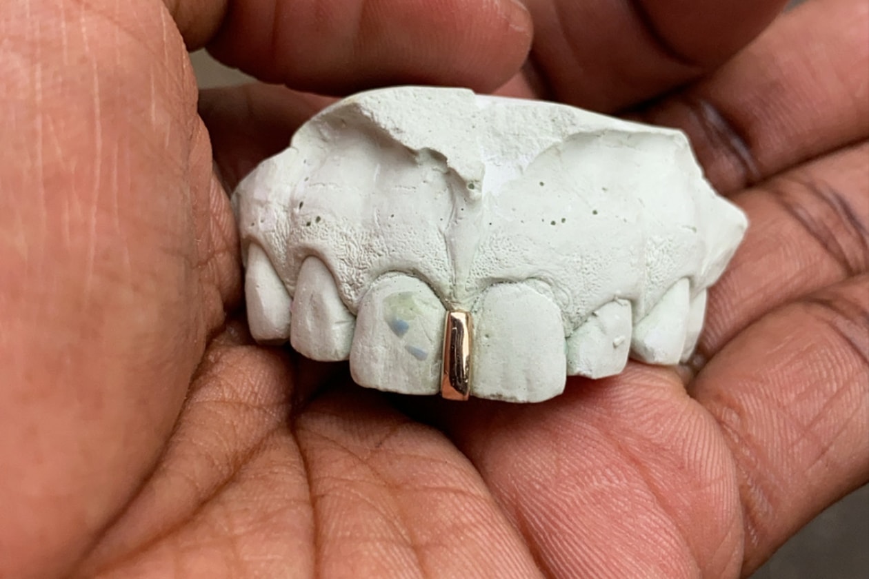 Helen Harris helenwiththegoldteeth Grillz New York Honeycomb Enamel Floating Letters Gemstones Opals Teardrop Gap Filler French Dip Diamond Cuts Openface Flats Caps Gold Teeth