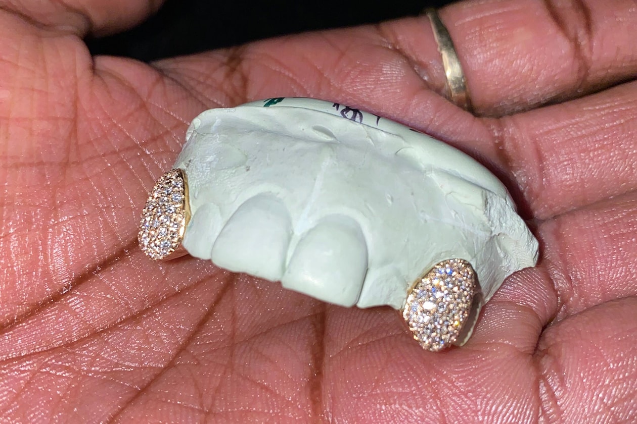 Helen Harris helenwiththegoldteeth Grillz New York Honeycomb Enamel Floating Letters Gemstones Opals Teardrop Gap Filler French Dip Diamond Cuts Openface Flats Caps Gold Teeth