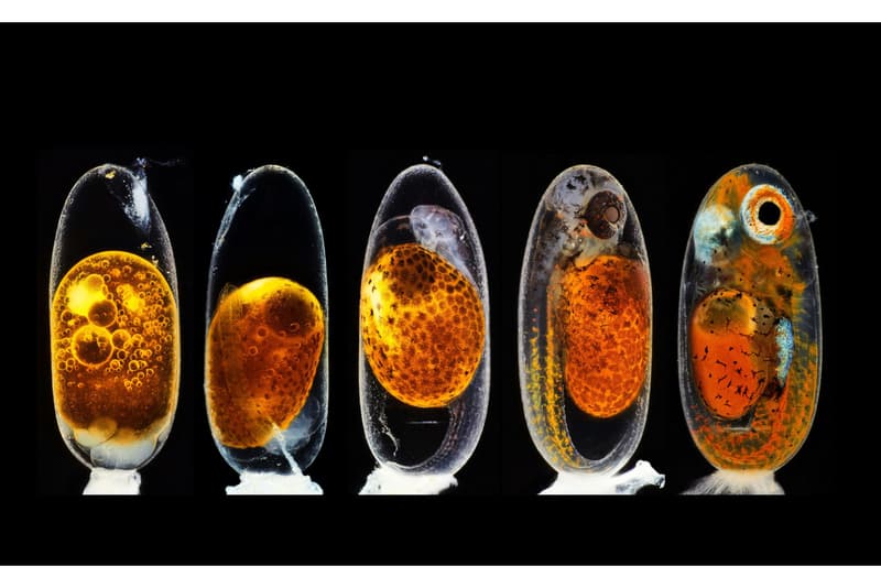 nikon small world photomicrography competition winners