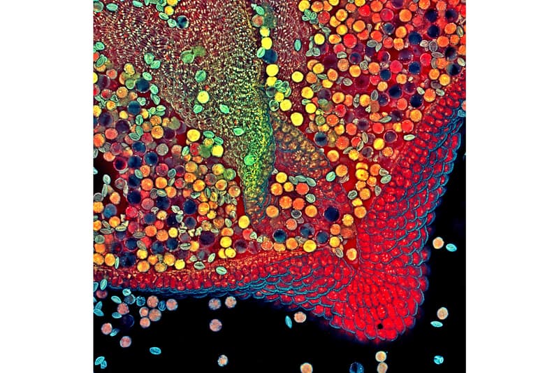 nikon small world photomicrography competition winners