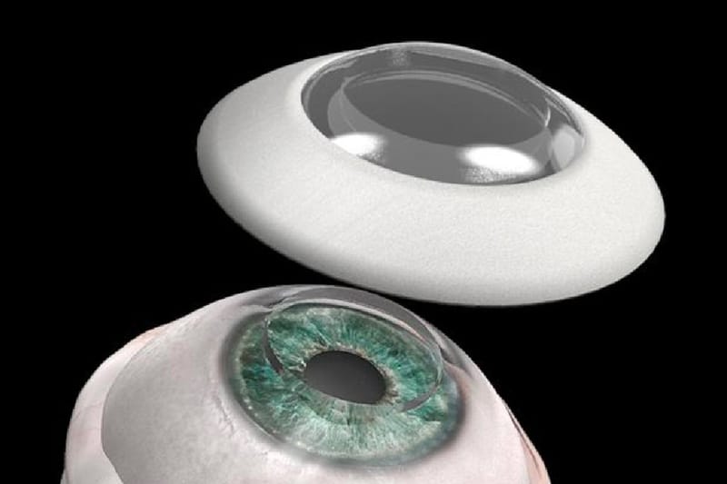 Artificial Cornea Implant Helps Legally-Blind Man Regain His Sight