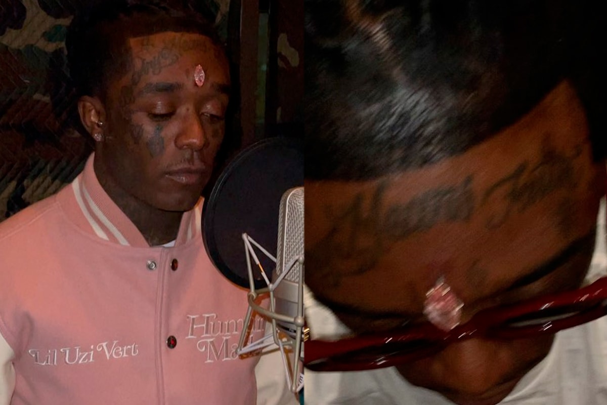 Lil Uzi Vert 24 Million USD Pink Diamond Implanted Forehead Eliantte & Co. Photo 