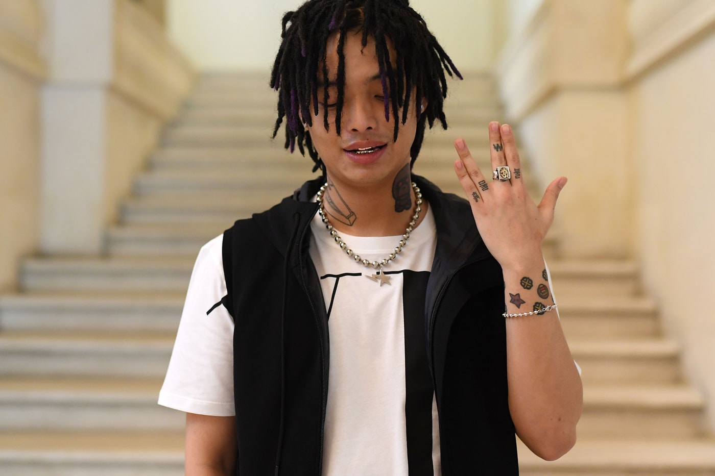 Keith Ape Illness Less Than Six Months To Live Info