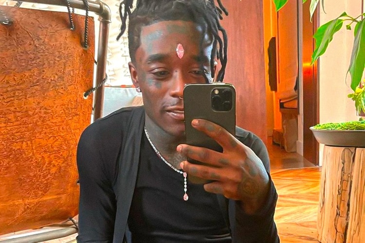 Lil Uzi Vert Has Seemingly Removed His $24 Million USD Forehead Diamond