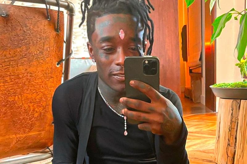 Lil Uzi Vert Removes 24 million USD Forehead Diamond implant eternal atake