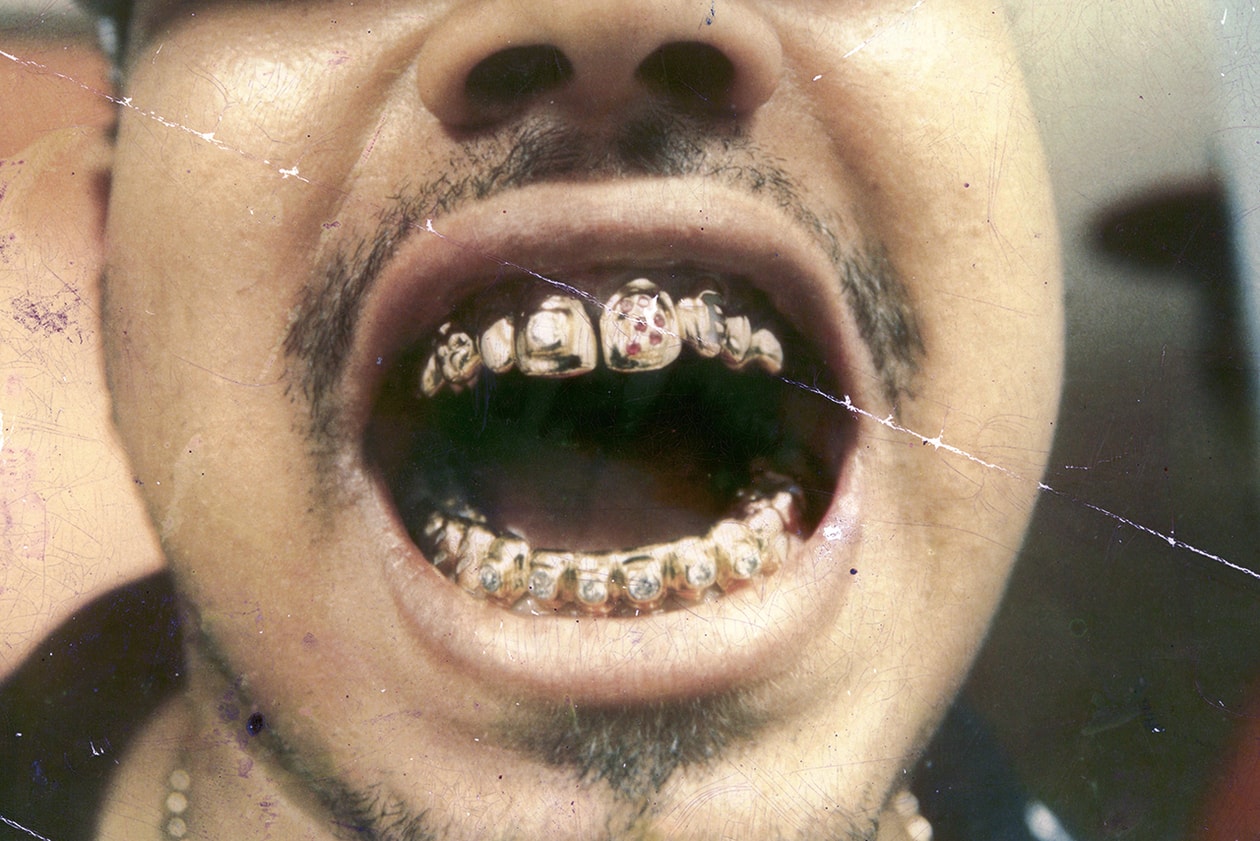 eddie plein mouth full of gold new york run dmc grills fronts 