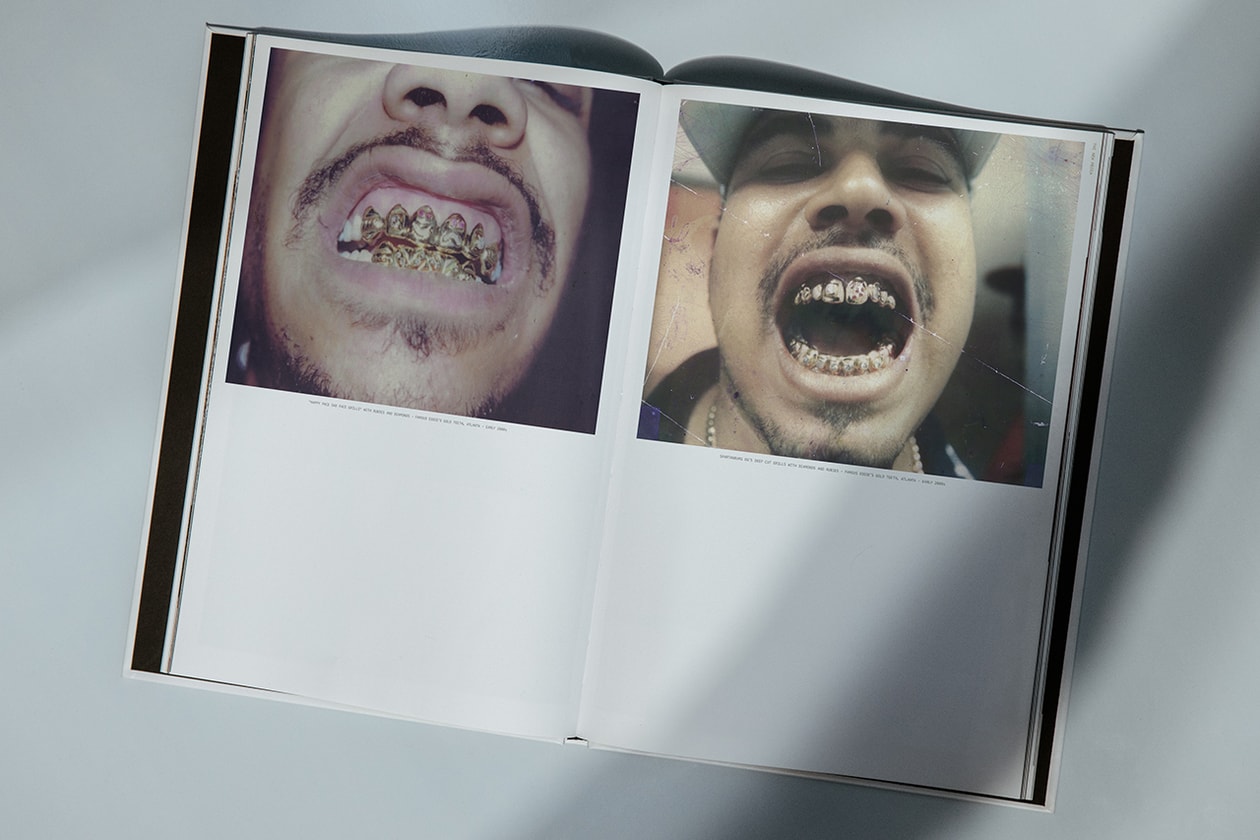 eddie plein mouth full of gold new york run dmc grills fronts 