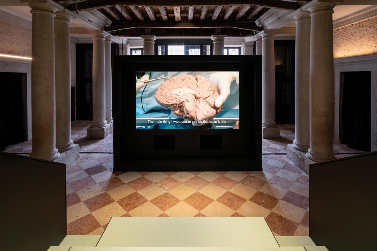 Fondazione Prada "Human Brains: It Begins with an Idea"