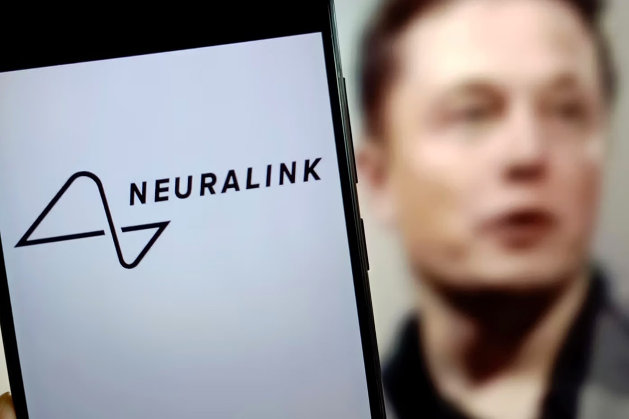 Top Tech News stories neuralink human test trials subject elon musk amazon generative ai alexa voice bot microsoft xbox document leak