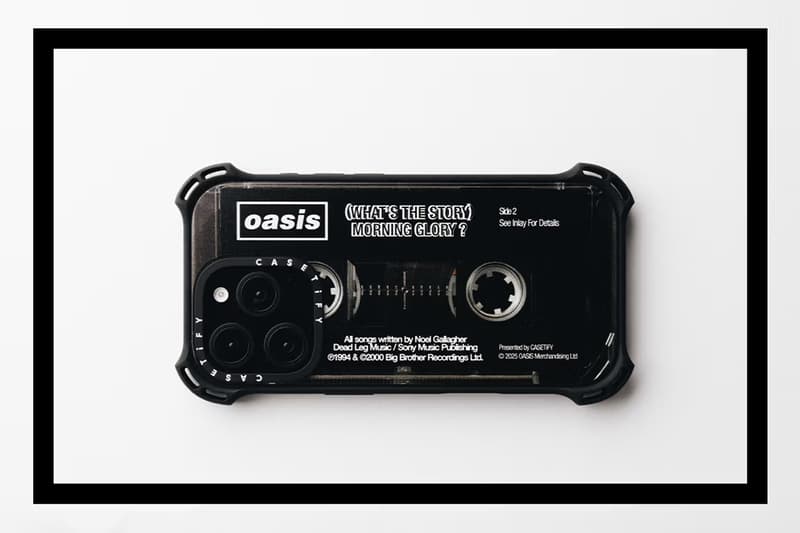 Oasis CASETiFY Collection Release Info