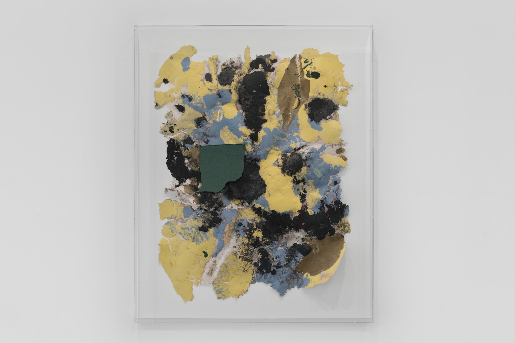 Hypeart Visits: Kennedy Yanko