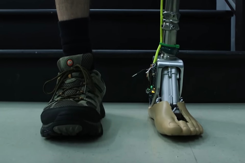 Smart prosthetic ankle takes fear out of rough terrain, stairs 