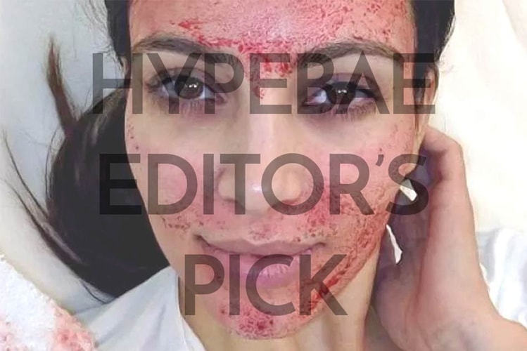 This $8 USD Facial Is a Bloody Mess but It Made My Skin Perfect