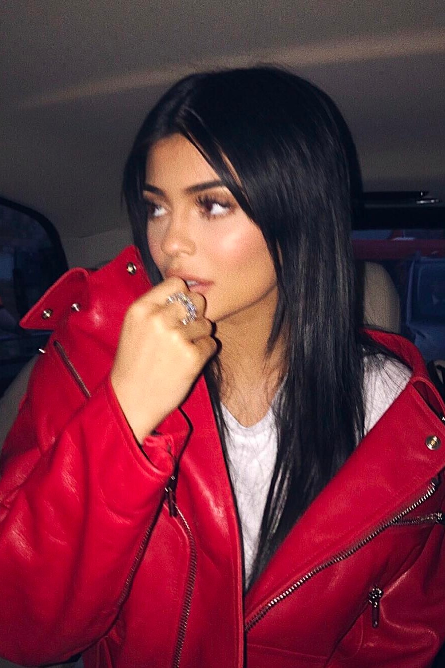 Kylie Jenner Lip Fillers Removed Instagram Surgery Natural