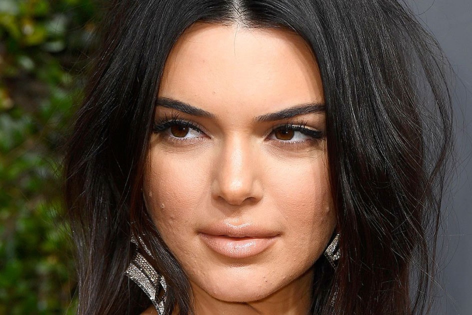 Acne Scarring Scar Pimples Kendall Jenner Golden Globes Red Carpet 2018 Face Makeup Skin Skincare