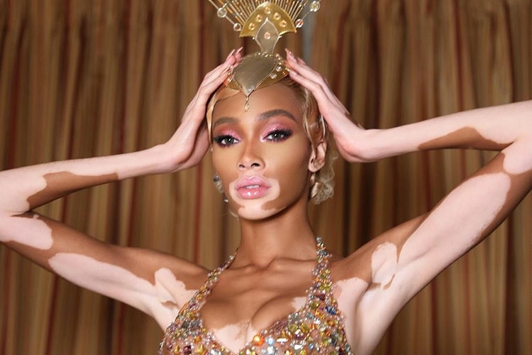 How Winnie Harlow Got Ready For Met Gala 2019, Inside Her "Carnival Queen" Camp