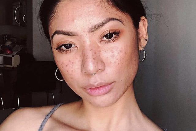 Here's the Easiest Way to Create the "Fake Freckles" Look