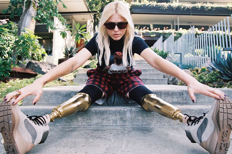 Lauren Wasser Toxic Shock Syndrome Advocate Hypebae