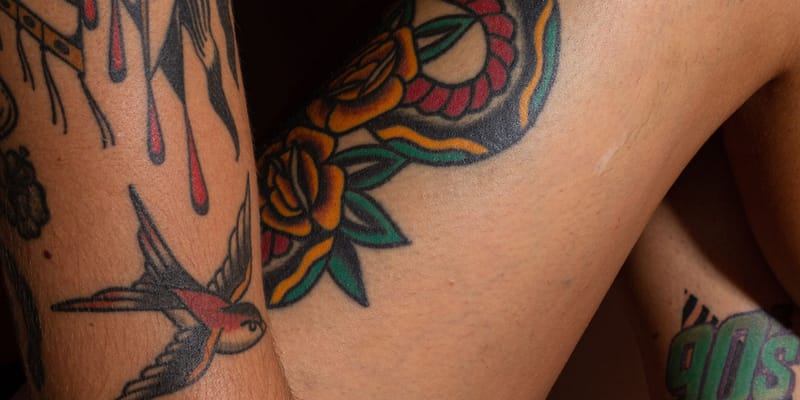 Tattoo Removal in Mansfield, TX | Laser Tattoo Removal